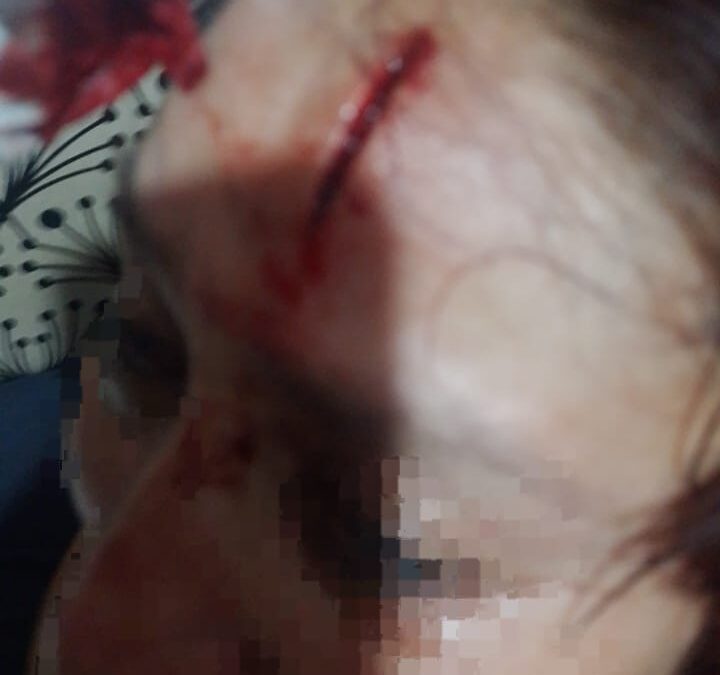 Machetean a mujer dentro de un hotel